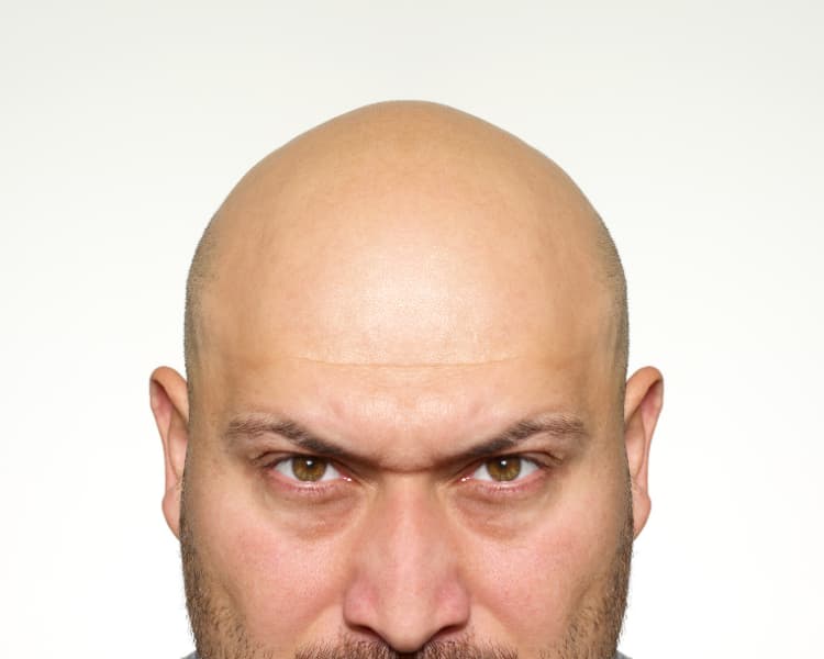 Bald man angry